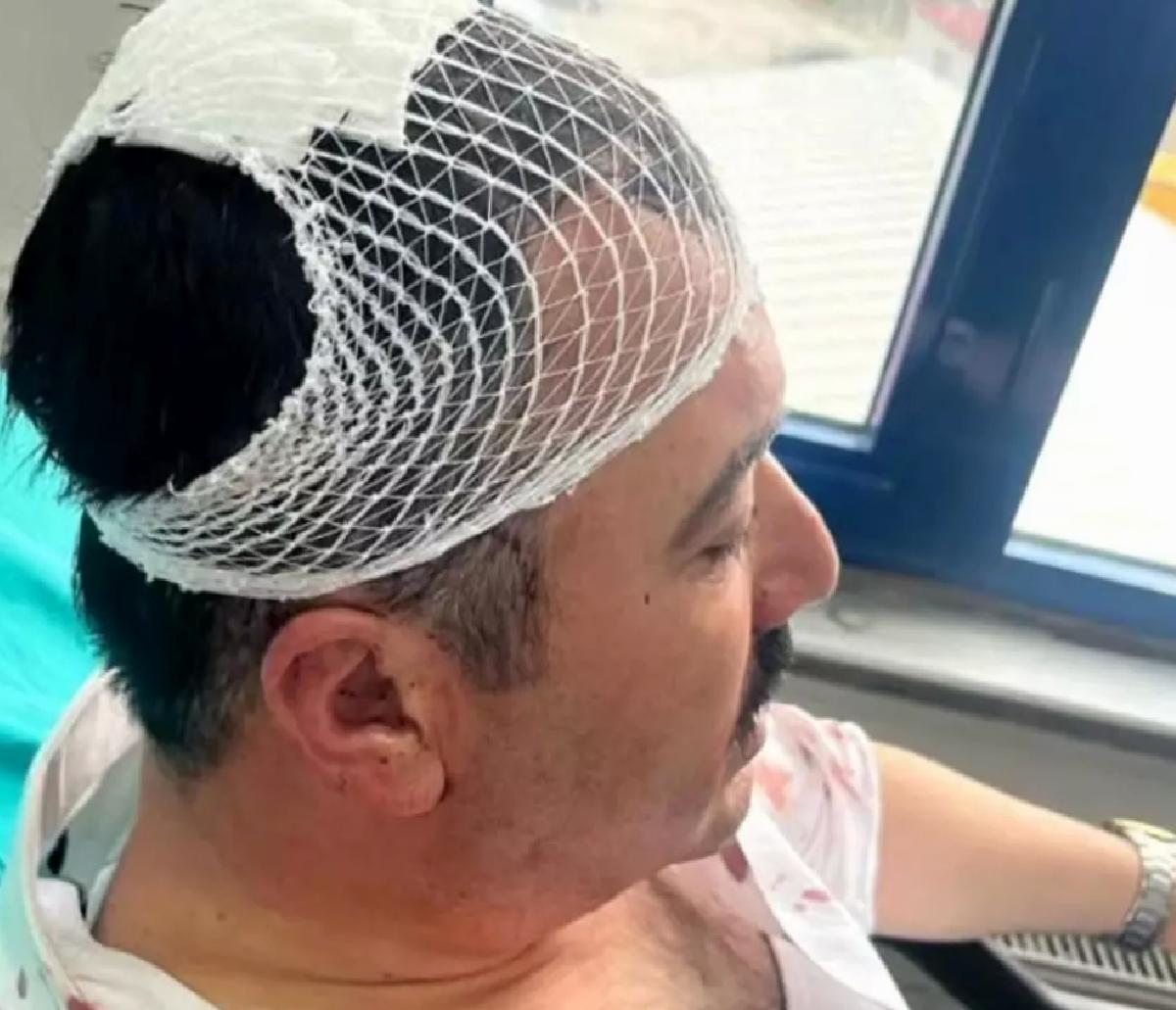 Siyasi Tartışma Sonrası Şekerlikle Yaralama Olayı: YRP Vilayet Lider Yardımcısı Tutuklandı