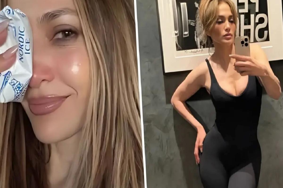 Jennifer Lopez, Amerikan Müzik Mükafatları provaları sırasında yüzünden yaralandı
