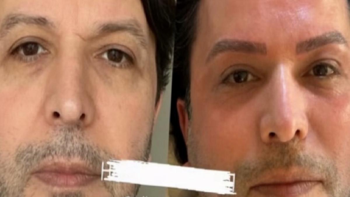 Nihat Doğan estetik süreç yaptırdı